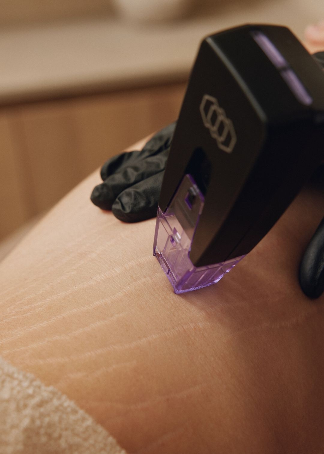 Микроигольчатый RF-лифтинг Morpheus 8 